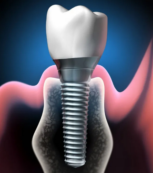 截圖14451.jpg 截圖14451.jpg