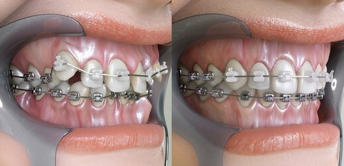 截圖14225.jpg 截圖14225.jpg