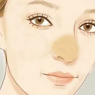 隆鼻13.png 隆鼻13.png